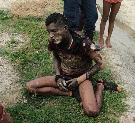 रुबि साह हत्या प्रकरणका आरोपित लक्ष्मण पासवानले आफूलाई आगो लगाए